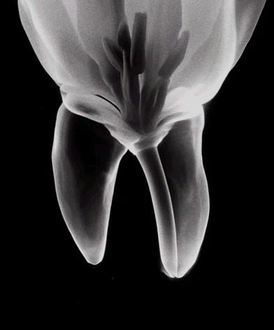 Radiografía artística de una pieza dental