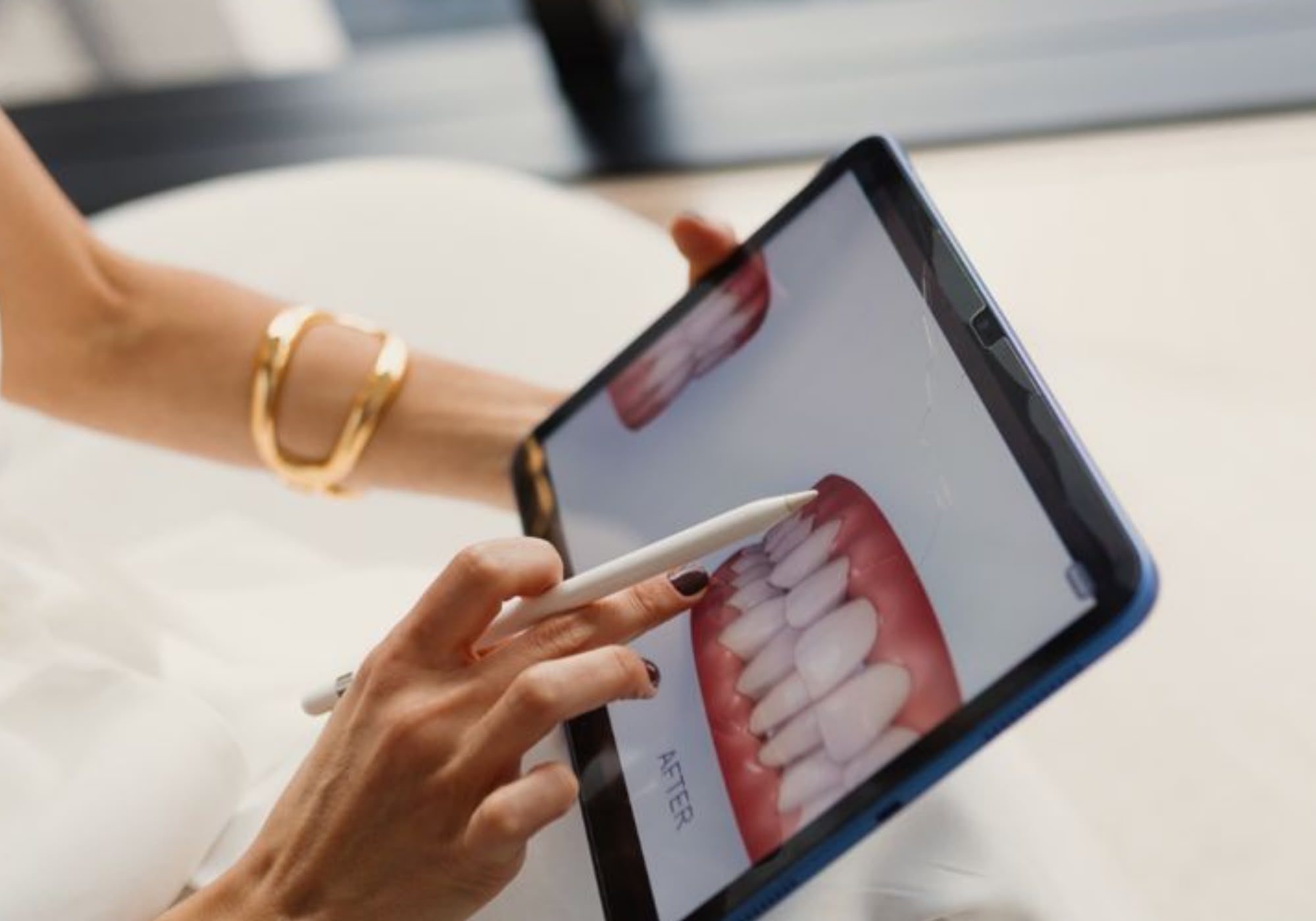 Diseño digital de la sonrisa en una tablet